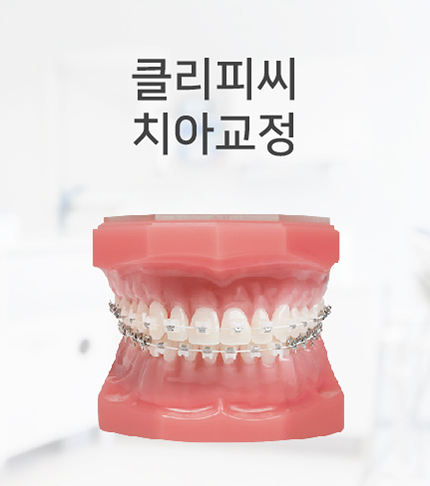 Ŭ���Ǿ�ġ�Ʊ���