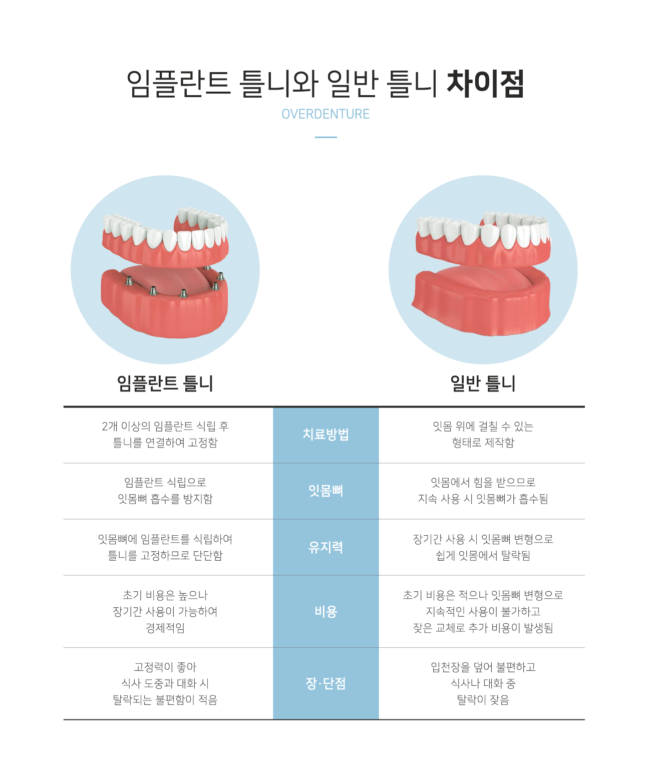 ���ö�Ʈ �ôϿ� �Ϲ� Ʋ�� ������ ��