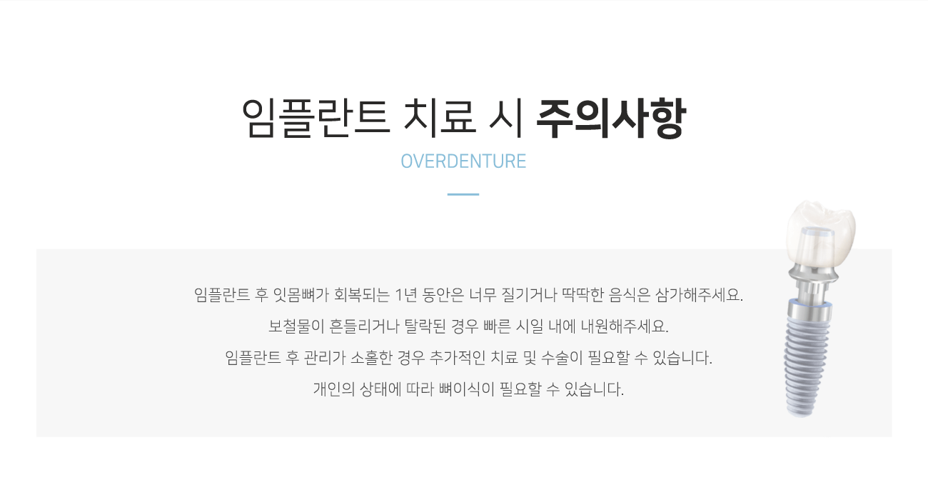 ���ö�Ʈ ġ�� �� ���ǻ���