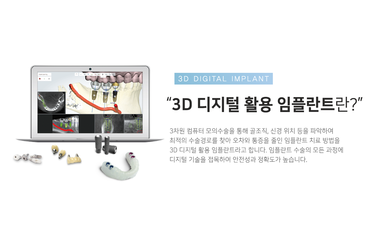 3D������Ȱ�����ö�Ʈ