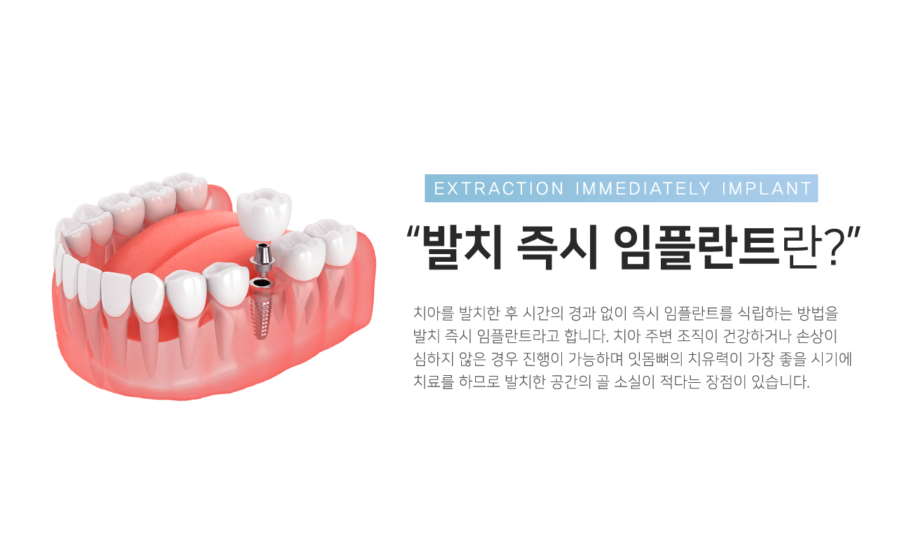 uv���ö�Ʈ�� �Ϲ� ���ö�Ʈ ������ ��