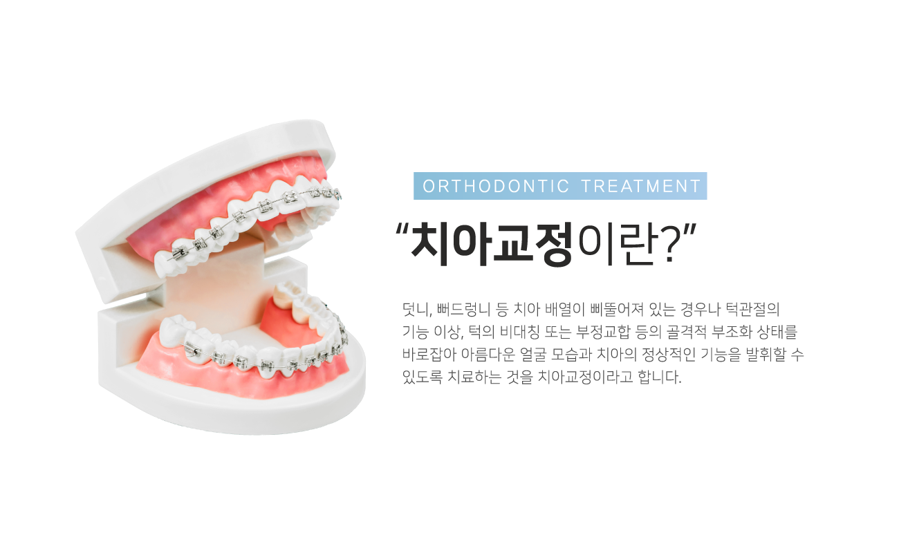 ġ�Ʊ����̶�?