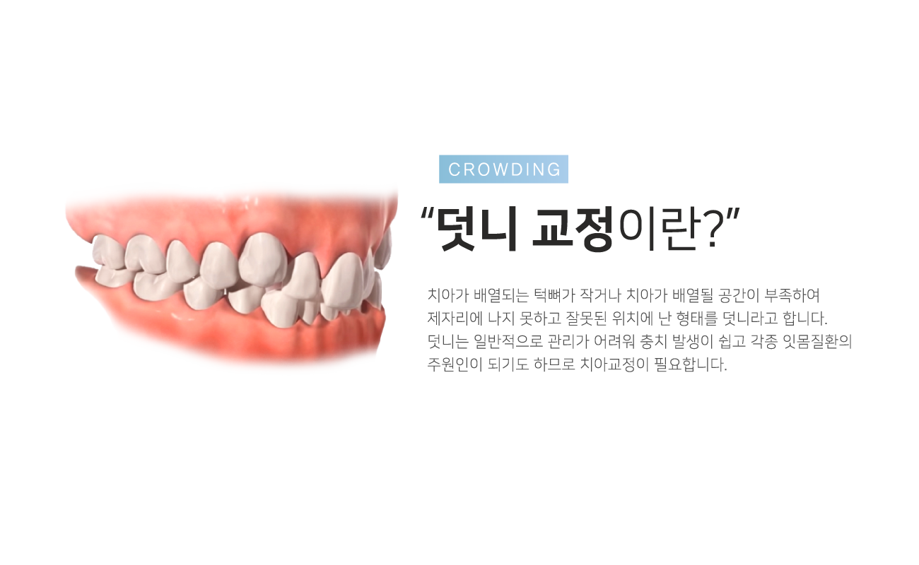 ���ϱ���