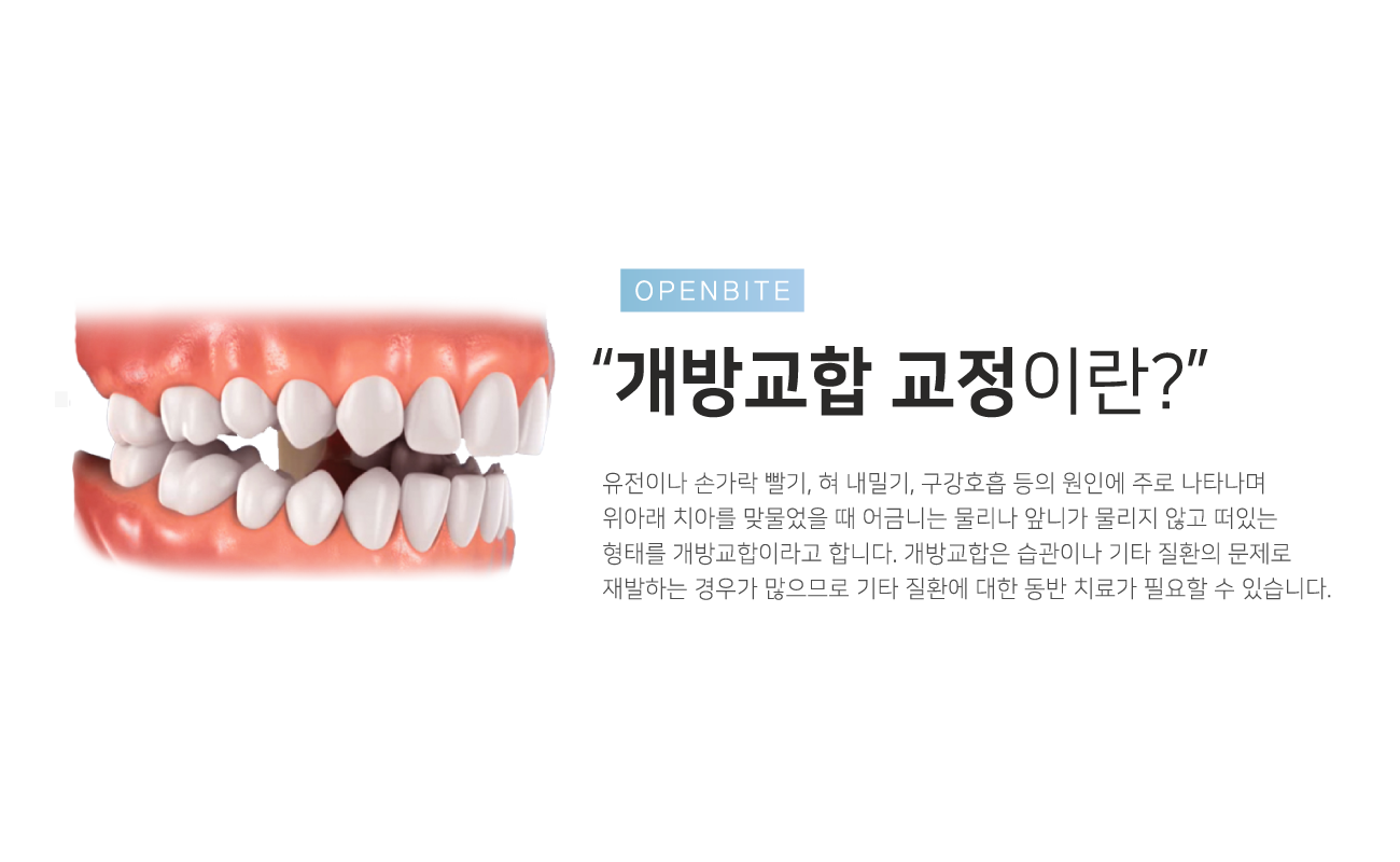 ���汳�� ����