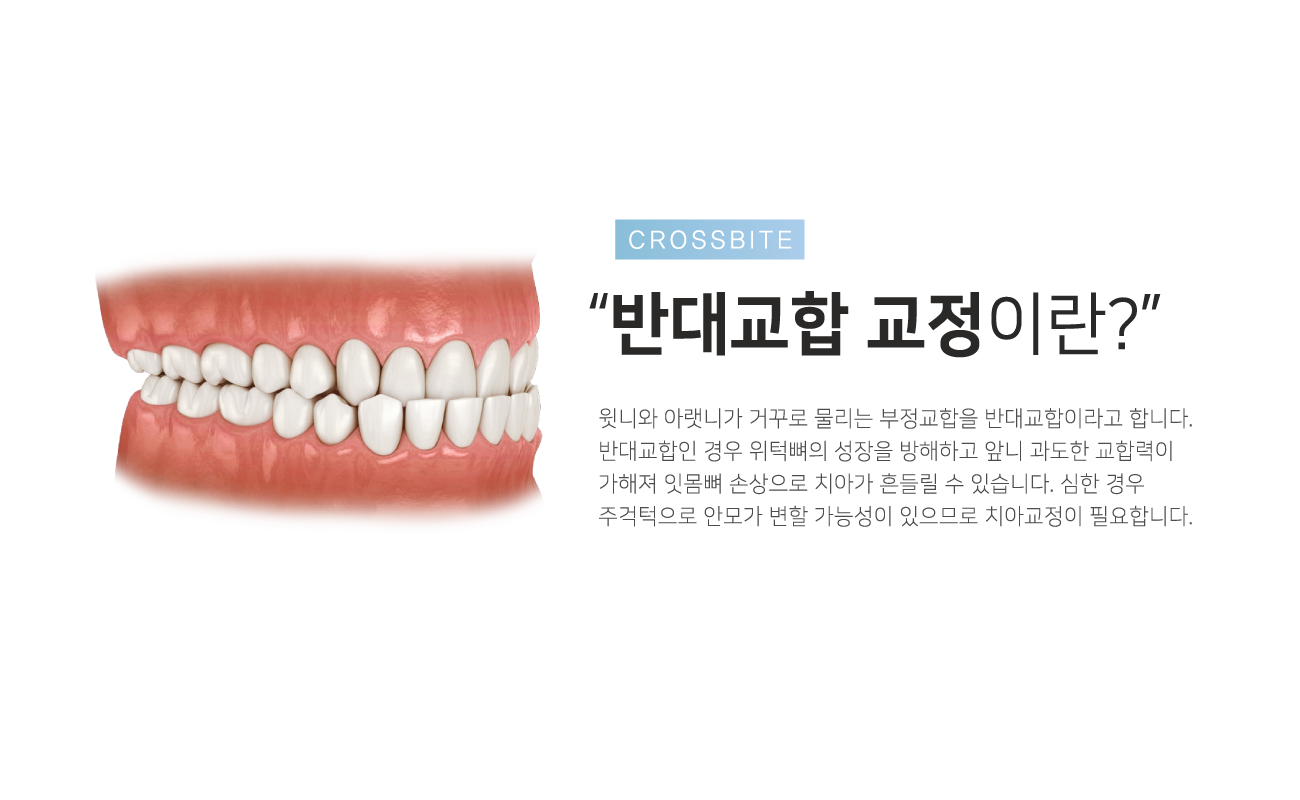 �ݴ뱳�� ����