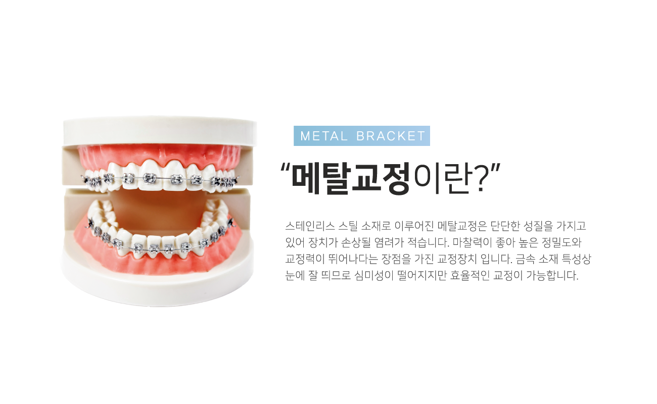 ��Ż�����̶�?