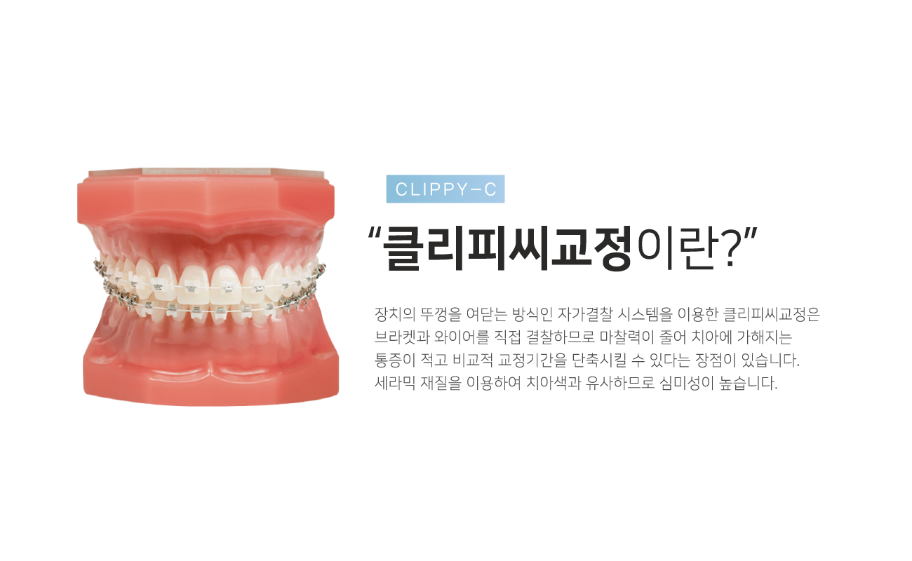 Ŭ���Ǿ������̶�?