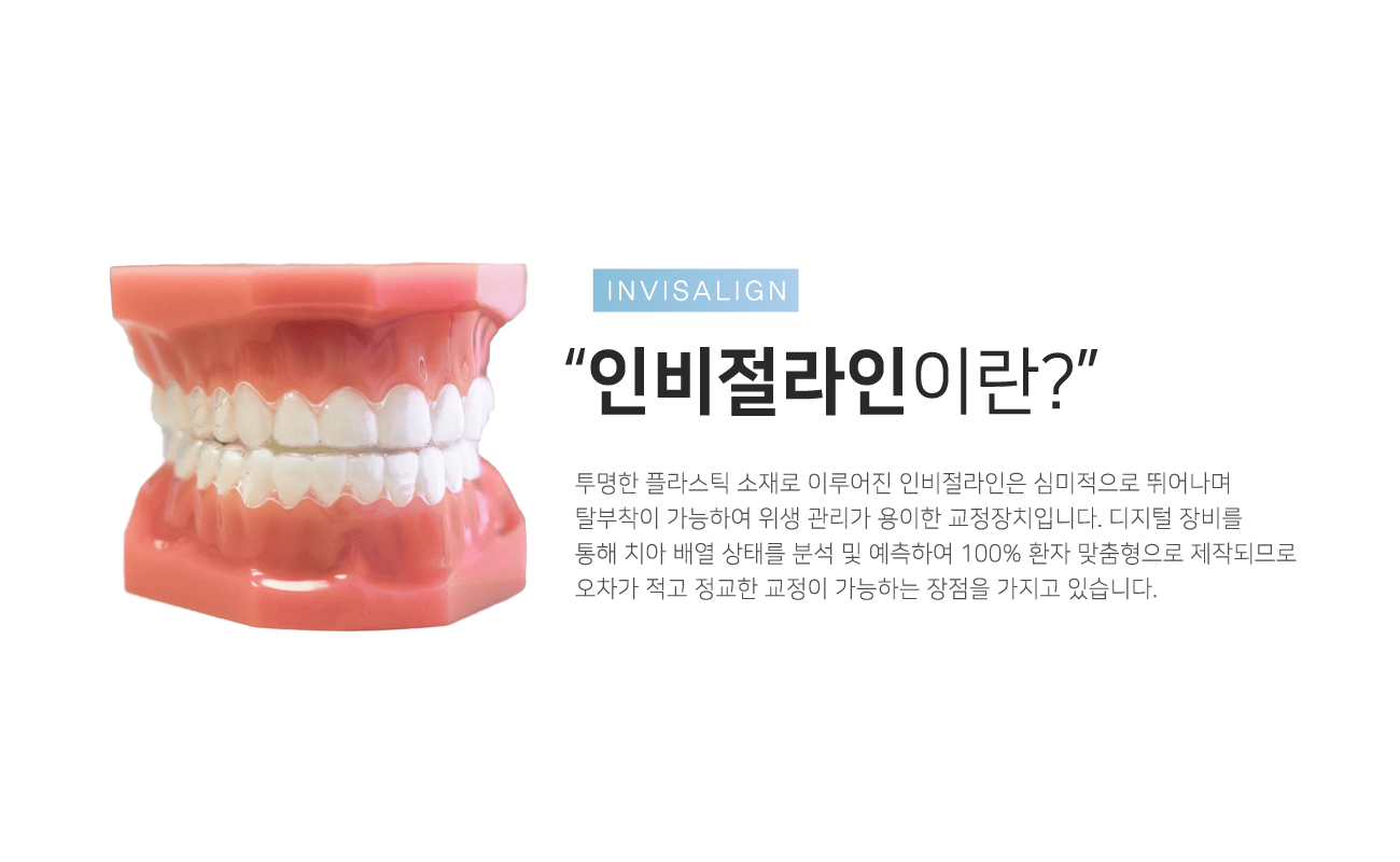 �κ��������̶�?