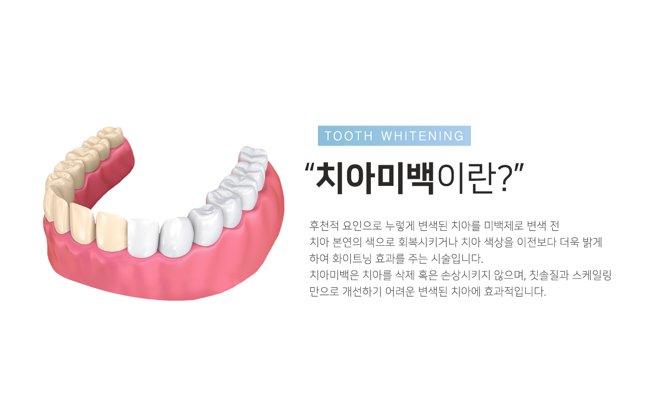 ġ�ƹ̹��̶�?