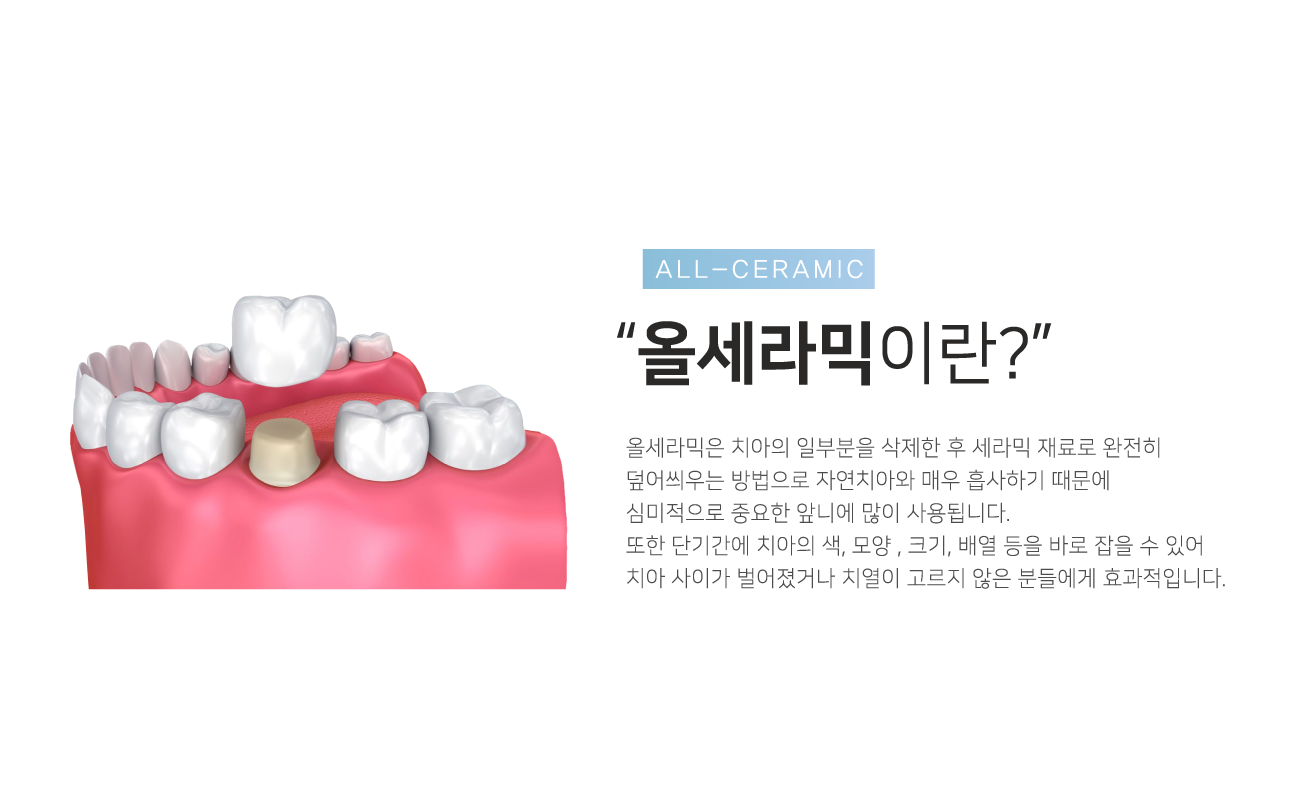 �ü�����̶�?