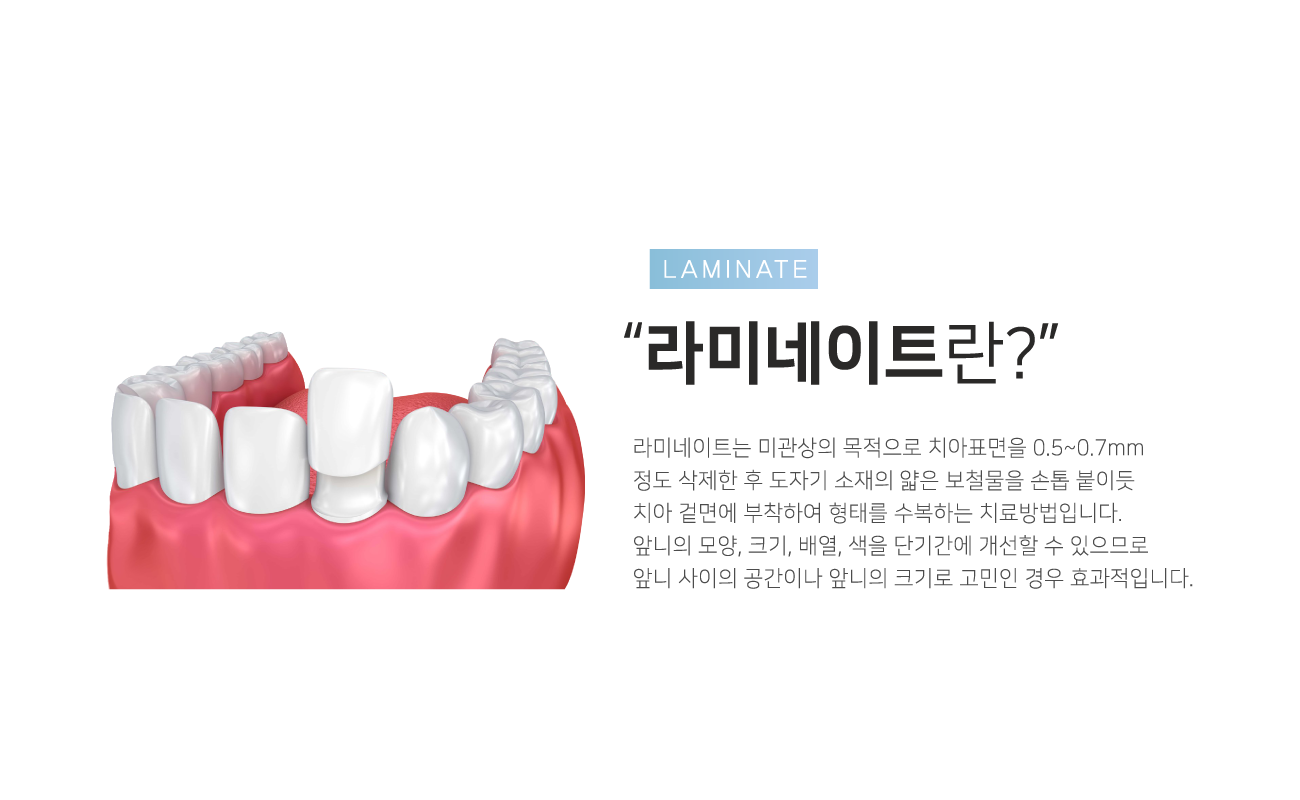 ��̳���Ʈ�̶�?