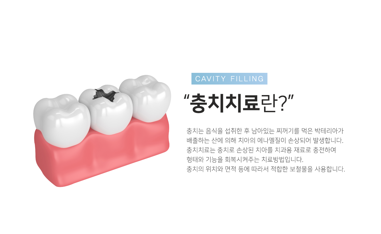 ��ġġ���?