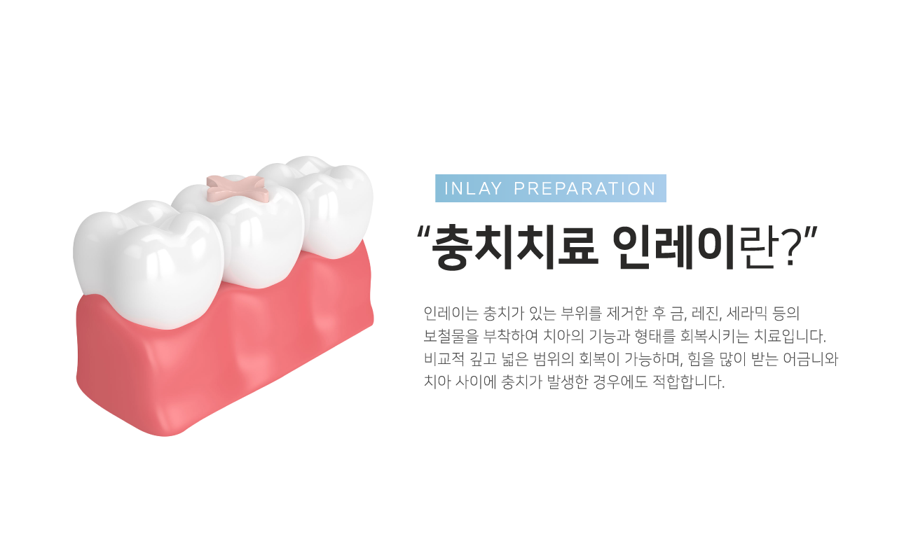 ��ġġ�� �η��̶�?