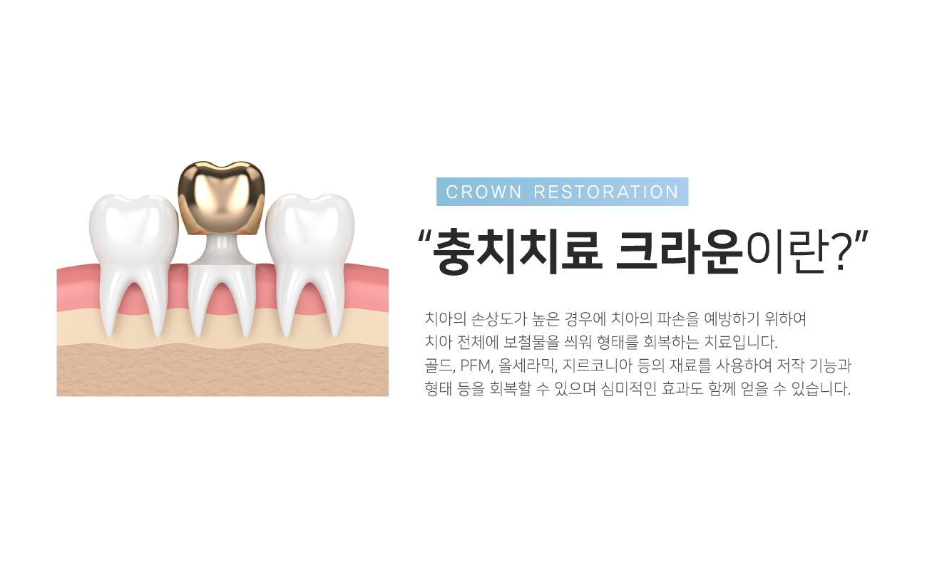 ��ġġ�� ũ����̶�?