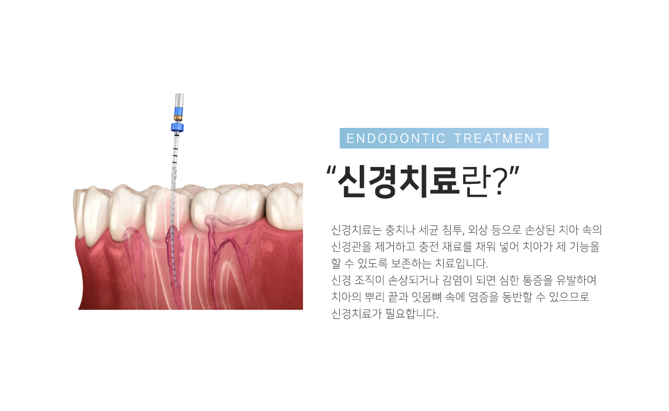 �Ű�ġ���?