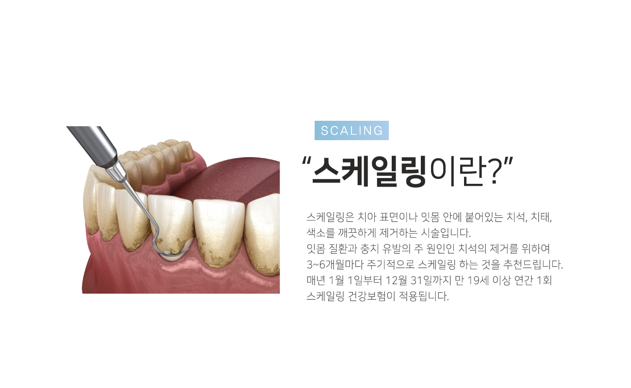 �����ϸ��̶�?