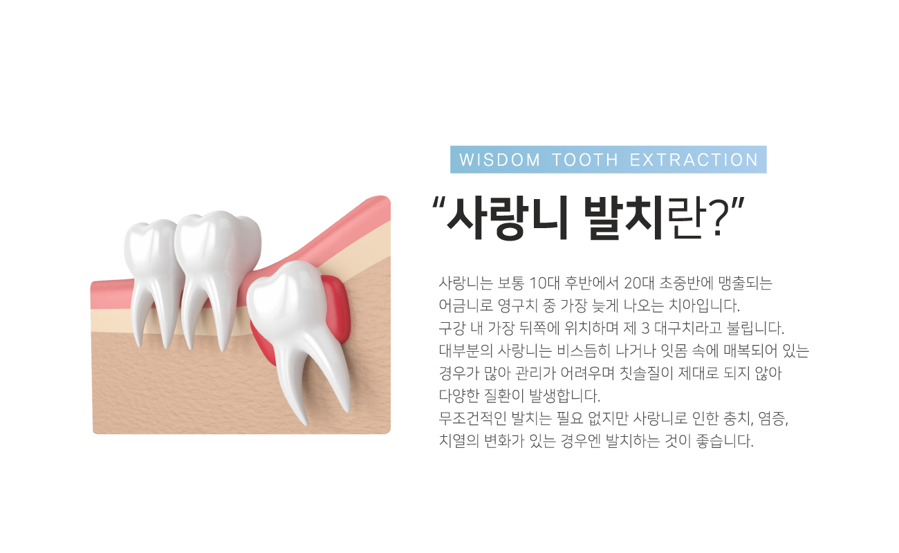 ����Ϲ�ġ��?