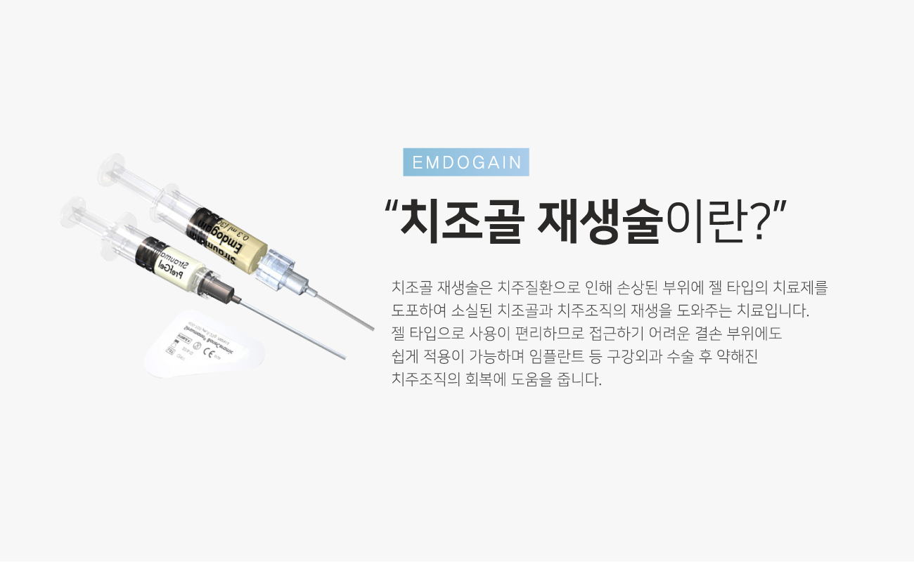 ġ���� ������̶�?