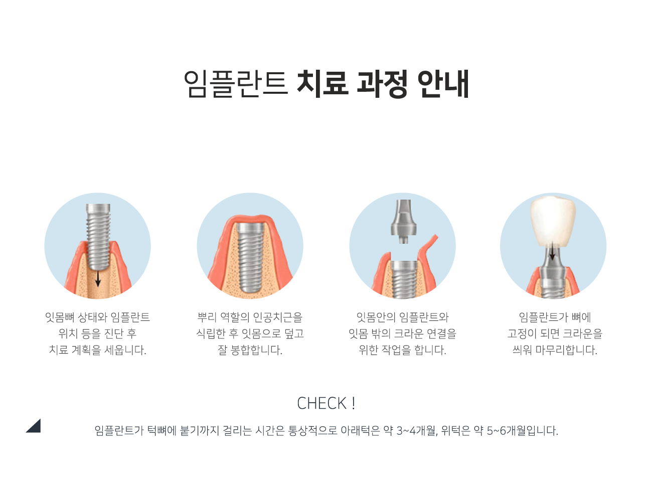 ���ö�Ʈ ġ�� ���� �ȳ�