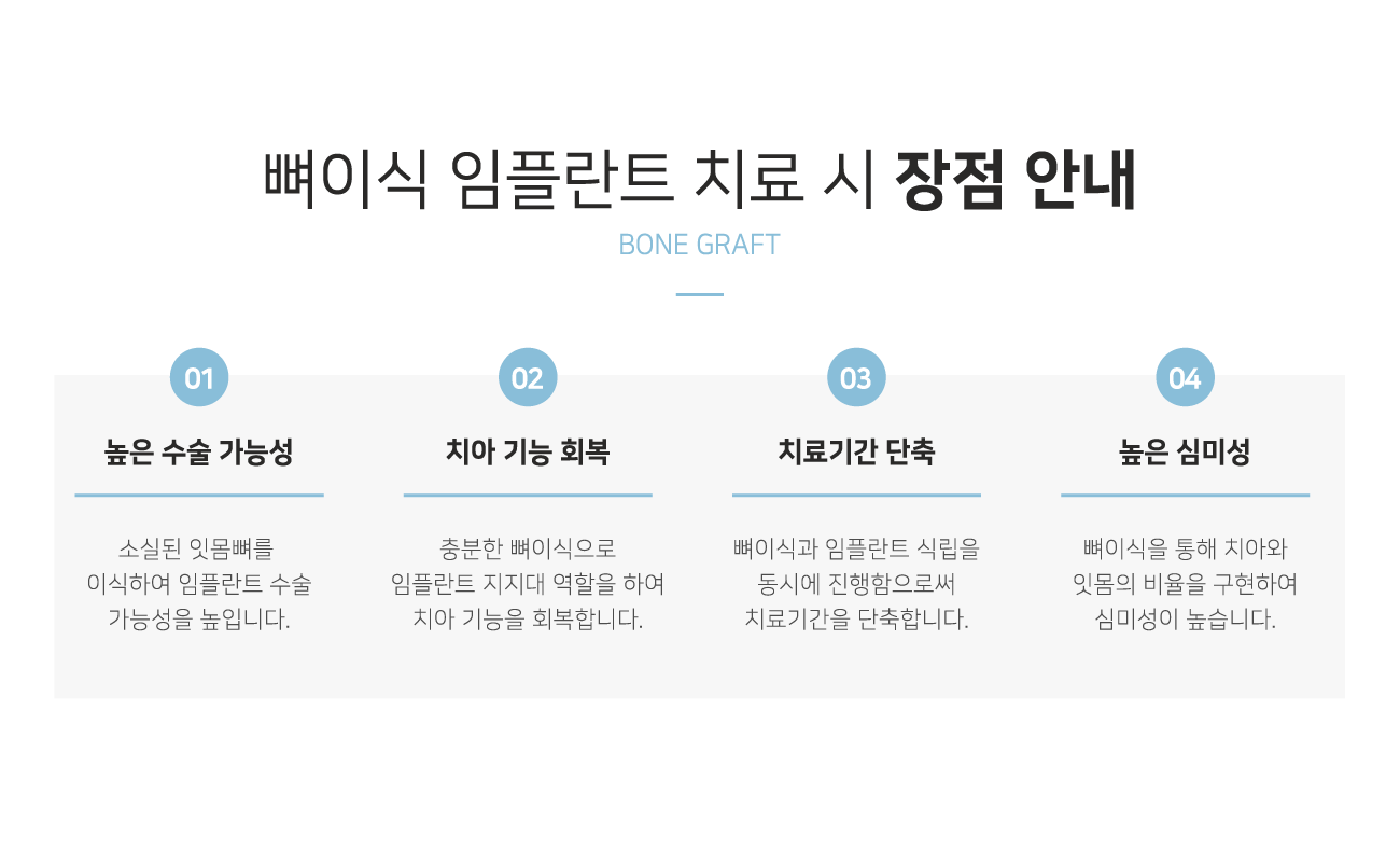 ���̽����ö�Ʈ ���� �ȳ�