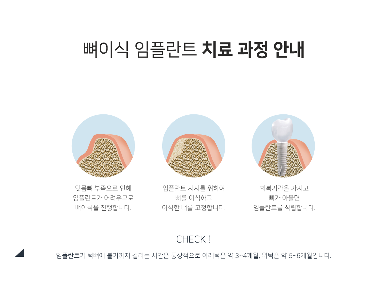 ���̽����ö�Ʈ ġ�� ���� �ȳ�