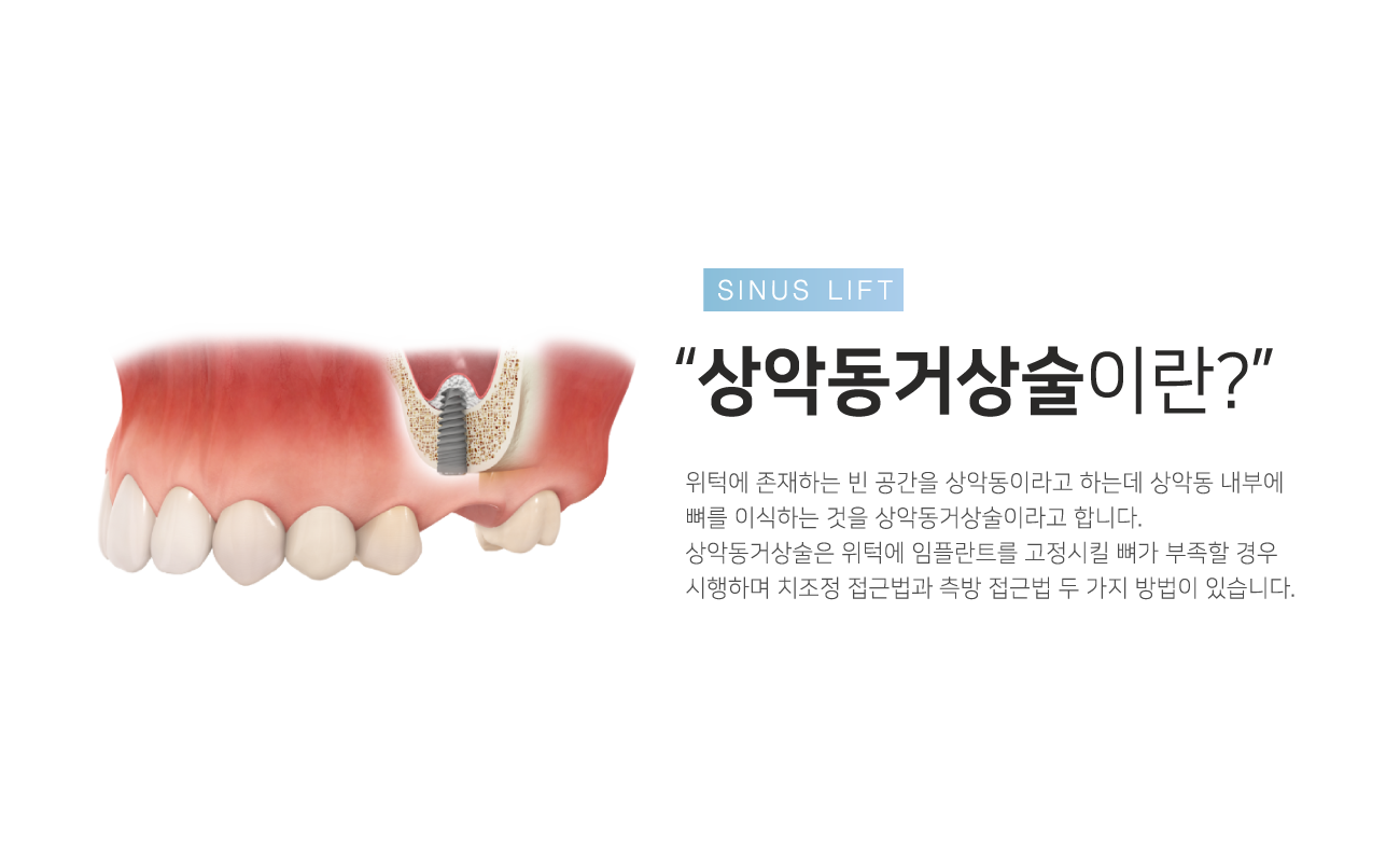 ��ǵ��Ż��