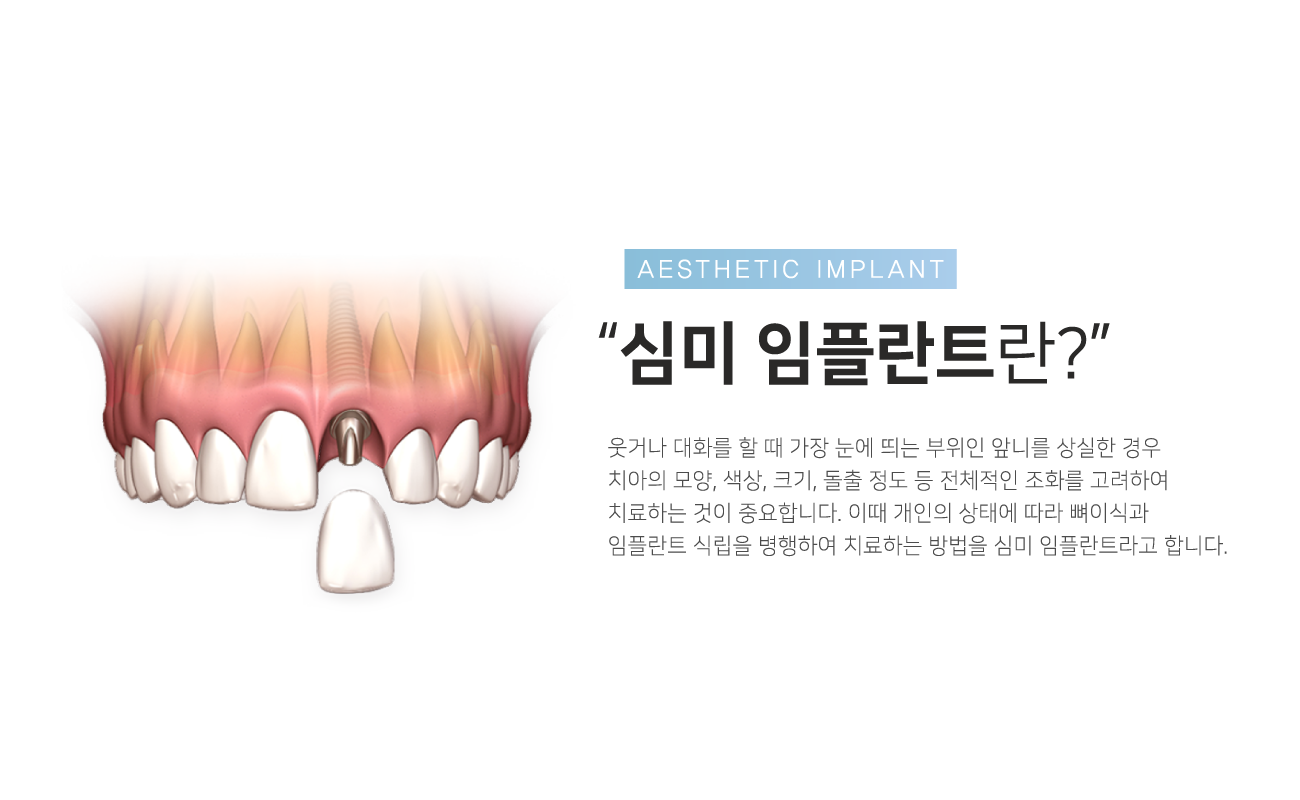 �ɹ����ö�Ʈ