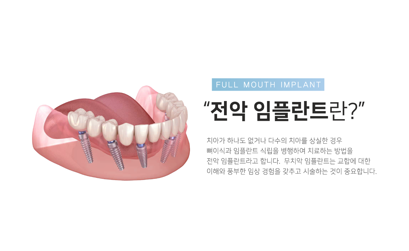 �������ö�Ʈ